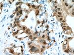 S100P Antibody in Immunohistochemistry (Paraffin) (IHC (P))