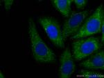 GNB3 Antibody in Immunocytochemistry (ICC/IF)