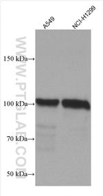 RBM15B Antibody in Western Blot (WB)