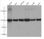 RBM15B Antibody in Western Blot (WB)