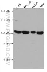 RBM15B Antibody in Western Blot (WB)