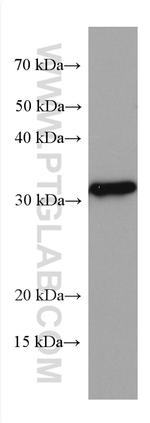 KLRB1/CD161 Antibody in Western Blot (WB)