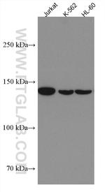 FMNL1 Antibody in Western Blot (WB)