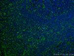 CD63 Antibody in Immunohistochemistry (Paraffin) (IHC (P))