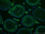 Cyclin B2 Antibody in Immunohistochemistry (Paraffin) (IHC (P))