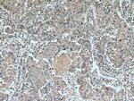 Cyclin B2 Antibody in Immunohistochemistry (Paraffin) (IHC (P))