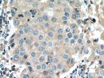 Cyclin B2 Antibody in Immunohistochemistry (Paraffin) (IHC (P))