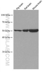 PPP2R2B Antibody in Western Blot (WB)