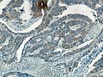 PKMYT1 Antibody in Immunohistochemistry (Paraffin) (IHC (P))