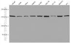 DAPK1 Antibody in Western Blot (WB)