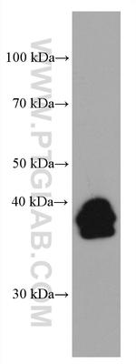 LMCD1 Antibody in Western Blot (WB)