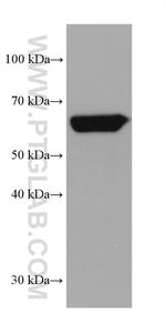 AFP Antibody in Western Blot (WB)