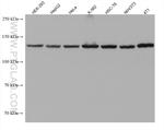 ValRS Antibody in Western Blot (WB)