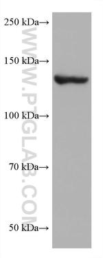 ValRS Antibody in Western Blot (WB)