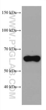 WDR1 Antibody in Western Blot (WB)