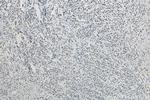 RALY Antibody in Immunohistochemistry (Paraffin) (IHC (P))