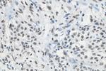 RALY Antibody in Immunohistochemistry (Paraffin) (IHC (P))