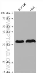 LASP1 Antibody in Western Blot (WB)