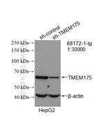TMEM175 Antibody in Western Blot (WB)