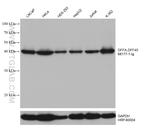 DFFA/DFF45 Antibody in Western Blot (WB)