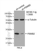 PSMB2 Antibody in Western Blot (WB)