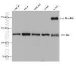 ABL1 Antibody in Western Blot (WB)