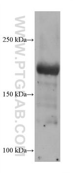 SCN5A Antibody in Western Blot (WB)