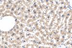 MTHFD1L Antibody in Immunohistochemistry (Paraffin) (IHC (P))