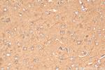 CCS Antibody in Immunohistochemistry (Paraffin) (IHC (P))