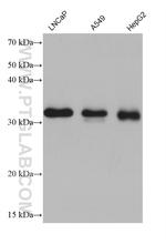 CCS Antibody in Western Blot (WB)