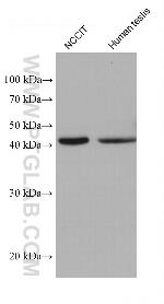 ARPM1 Antibody in Western Blot (WB)