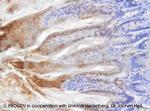 Cytokeratin 20 Antibody in Immunohistochemistry (IHC)