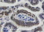 Cytokeratin 20 Antibody in Immunohistochemistry (IHC)