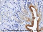 Cytokeratin 20 Antibody in Immunohistochemistry (IHC)