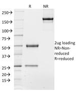 TCF4 (Transcription Factor 4) Antibody in SDS-PAGE (SDS-PAGE)