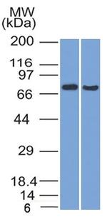 TCF4 (Transcription Factor 4) Antibody in Western Blot (WB)