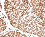 TCF4 (Transcription Factor 4) Antibody in Immunohistochemistry (Paraffin) (IHC (P))