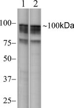 NIK Antibody in Western Blot (WB)