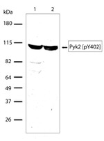 Phospho-PYK2 (Tyr402) Antibody in Western Blot (WB)