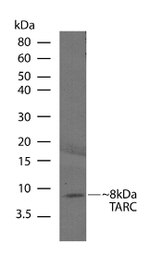 TARC Antibody in Western Blot (WB)