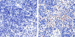 FOXP3 Antibody in Immunohistochemistry (Paraffin) (IHC (P))