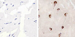 Phospho-GSK3B (Ser9) Antibody in Immunohistochemistry (Paraffin) (IHC (P))