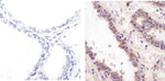 Phospho-GSK3B (Ser9) Antibody in Immunohistochemistry (Paraffin) (IHC (P))