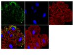 SMAD7 Antibody in Immunocytochemistry (ICC/IF)