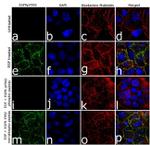 Phospho-EGFR (Tyr992) Antibody in Immunocytochemistry (ICC/IF)