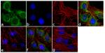 Phospho-MYL9 (Thr18, Ser19) Antibody in Immunocytochemistry (ICC/IF)