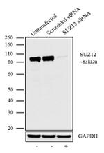 SUZ12 Recombinant Monoclonal Antibody (7H26L21) (702490)