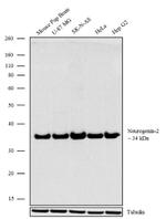 Neurogenin 2 Recombinant Rabbit Monoclonal Antibody (15H30L21)