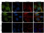 Ataxin 3 Antibody in Immunocytochemistry (ICC/IF)