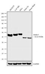 Ataxin 3 Recombinant Rabbit Monoclonal Antibody (13H9L9)
